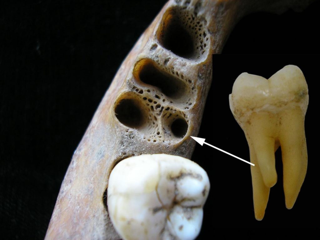 Archaic man meets Homo Sapiens in Asia