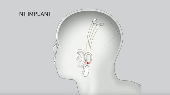 neuralink link man machine